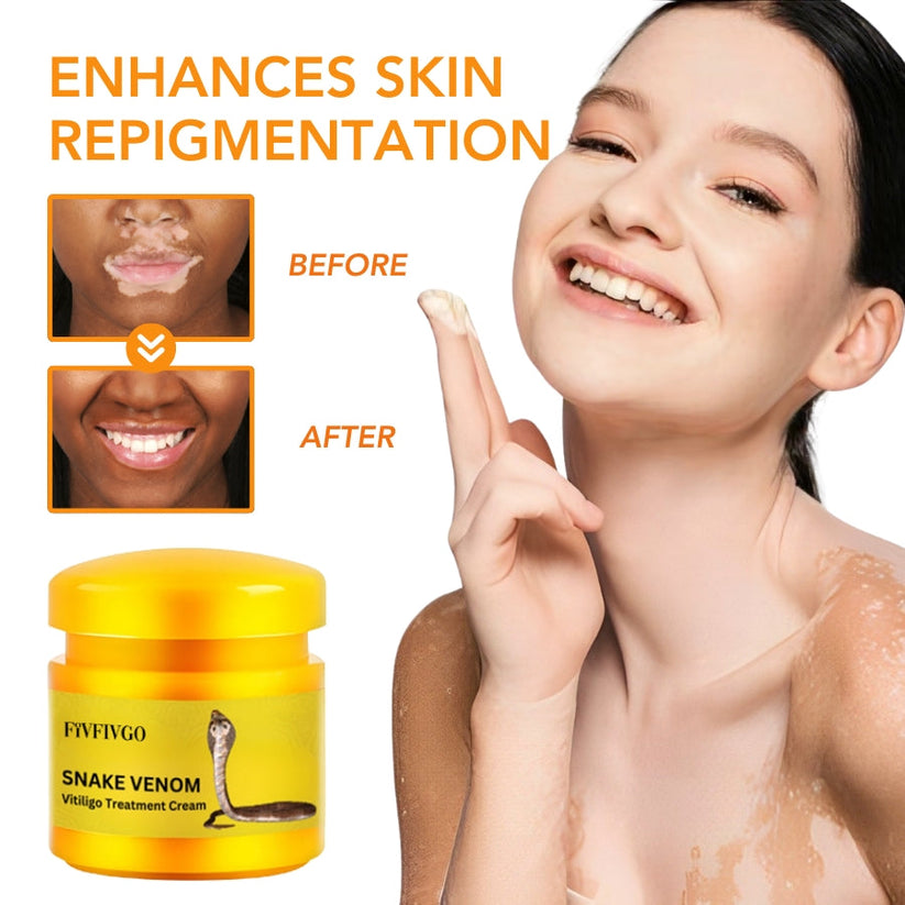Fivfivgo™ Snake Venom Vitiligo Treatment Cream