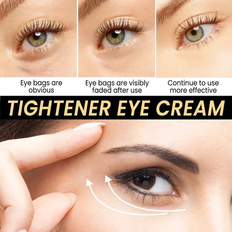 đ„LAST DAY 30%OFFđ„ - Fast Firming Eye Cream