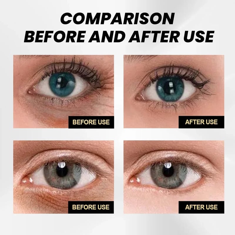 đ„LAST DAY 30%OFFđ„ - Fast Firming Eye Cream