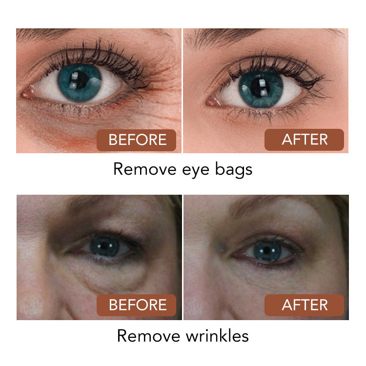 CAVIAR ESSENCE ANTI WRINKLE EYE CREAM🔥HOT SALE 47%🔥【buy one get one free】