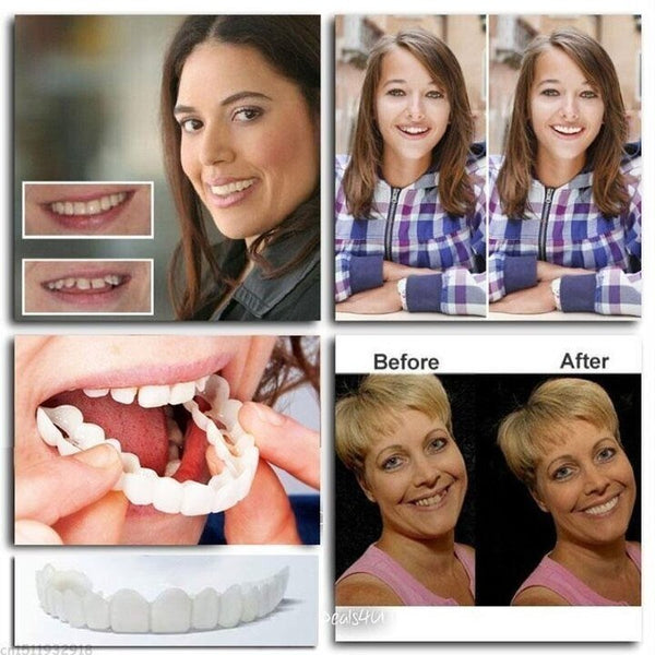💝Last day discount-49%Off💝Latest👨‍⚕Adjustable Snap-On Dentures😁