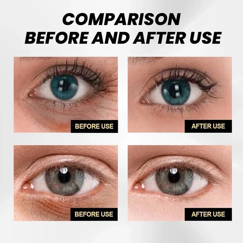 🔥LAST DAY 30%OFF🔥 - Fast Firming Eye Cream