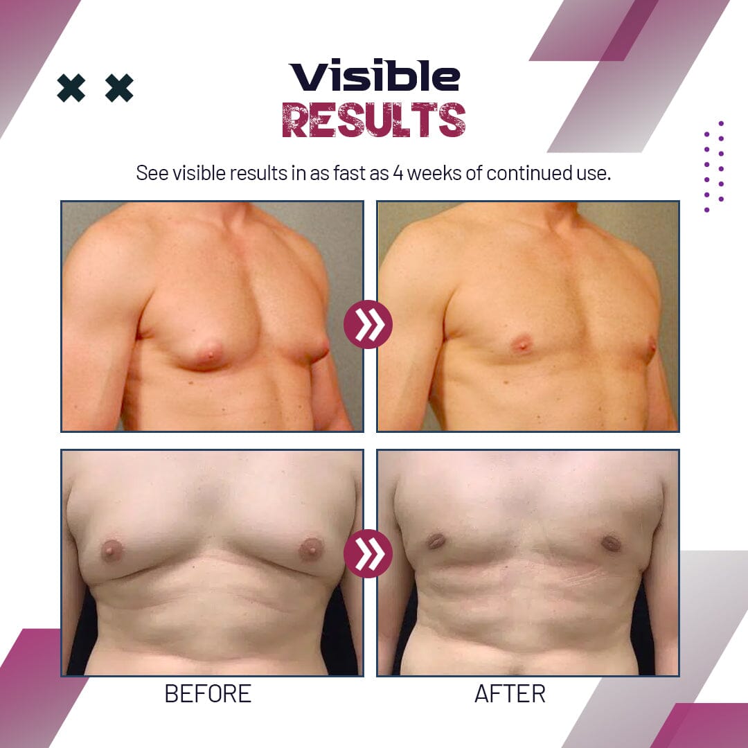 AUCHEST Gynecomastia Reduction Spray